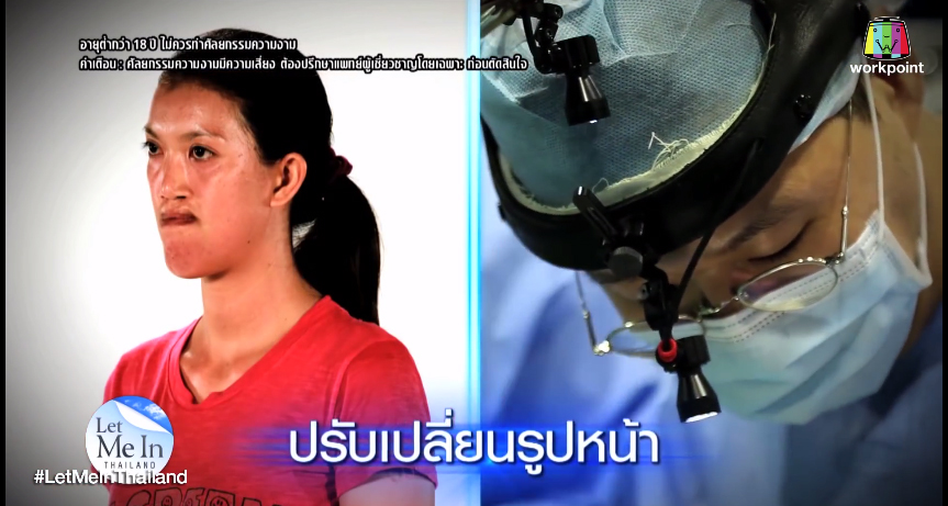 เอฟ วลีรัจน์ let me in