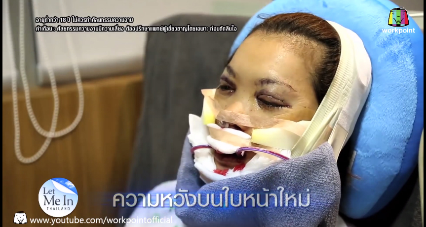 เอฟ วลีรัจน์ let me in