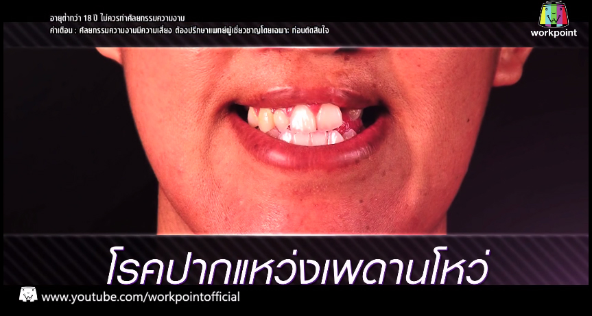 เอฟ วลีรัจน์ let me in