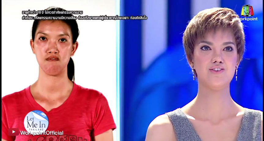 เอฟ วลีรัจน์ let me in