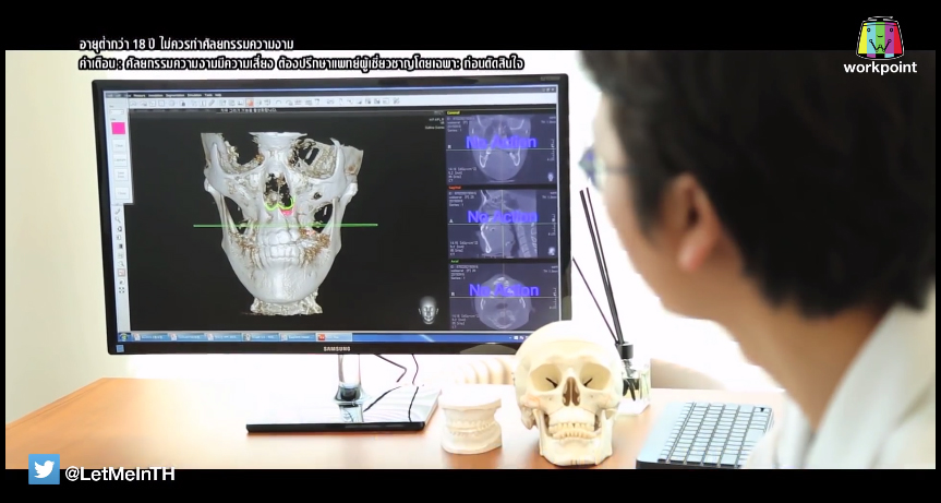 เอฟ วลีรัจน์ let me in