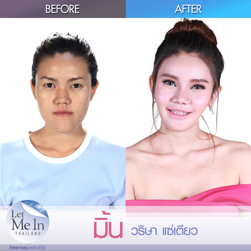 มิ้น let me in