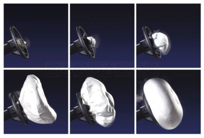 ถุงลมนิรภัย