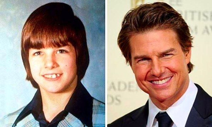 Tom Cruise ชายผู้บกพร่องในการอ่านสู่ซุปตาร์ระดับตำนาน
