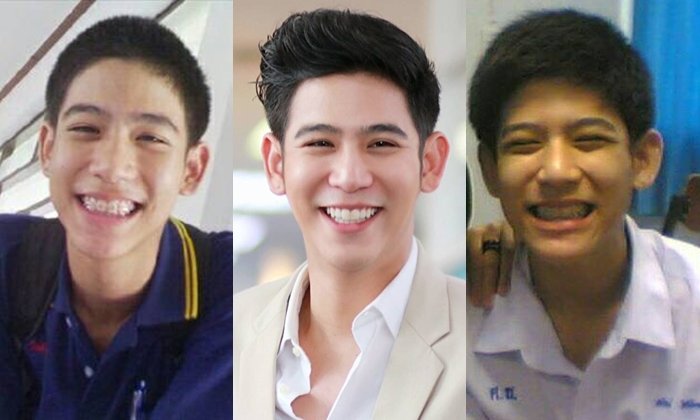 ย้อนวัยใส "พอร์ช-ศรัณย์" หนุ่มน้อยดัดฟันหูกาง สู่พระเอกสุดฮอต งานดีแต่เด็ก