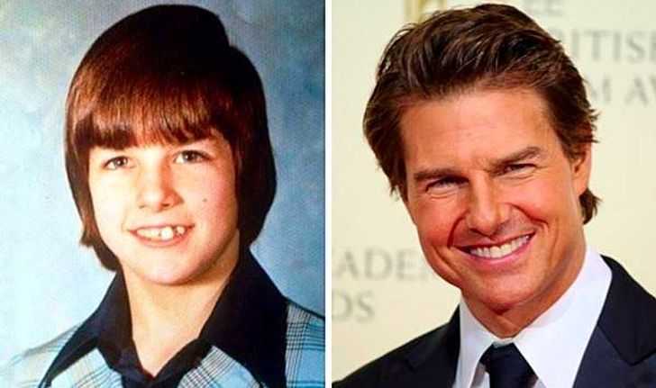 Tom Cruise ชายผู้บกพร่องในการอ่านสู่ซุปตาร์ระดับตำนาน