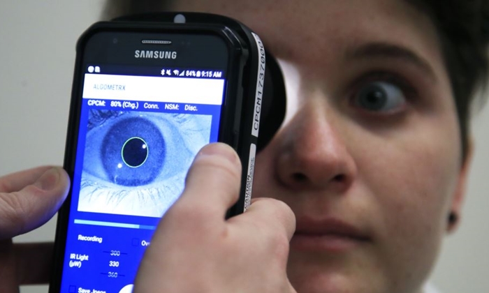 นักวิทยาศาสตร์ศึกษารูม่านตาและคลื่นสมองเพื่อวัดระดับ 'ความเจ็บปวด'