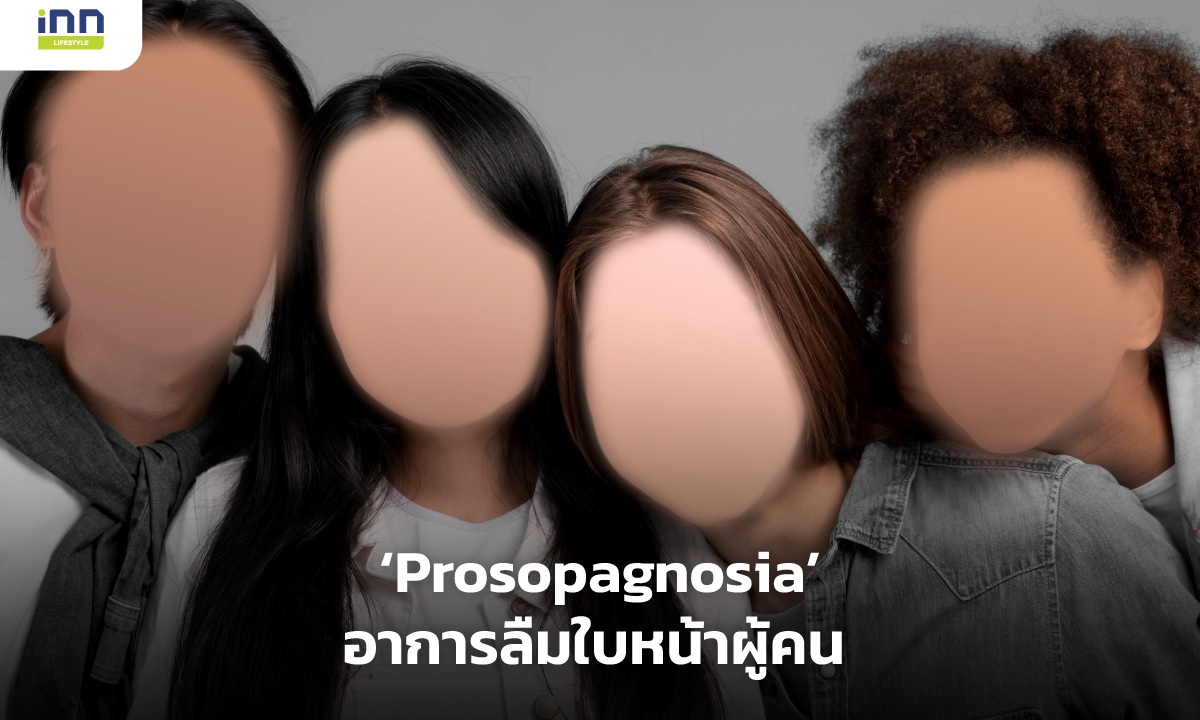 Prosopagnosia อาการลืมใบหน้าผู้คน