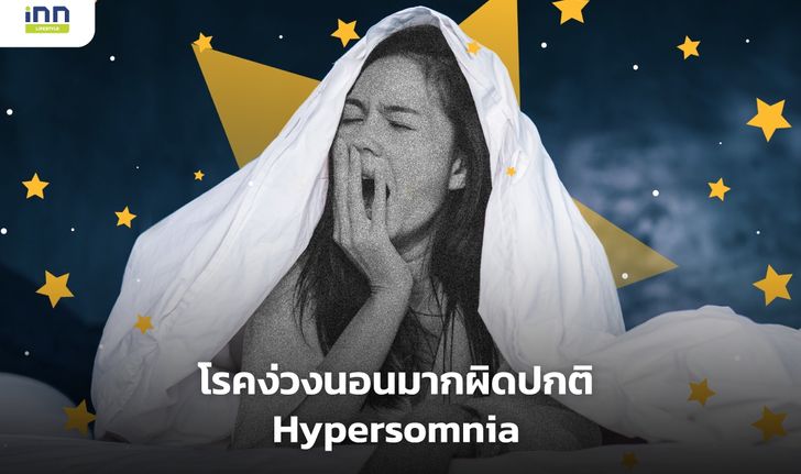 โรคง่วงนอนมากผิดปกติ Hypersomnia