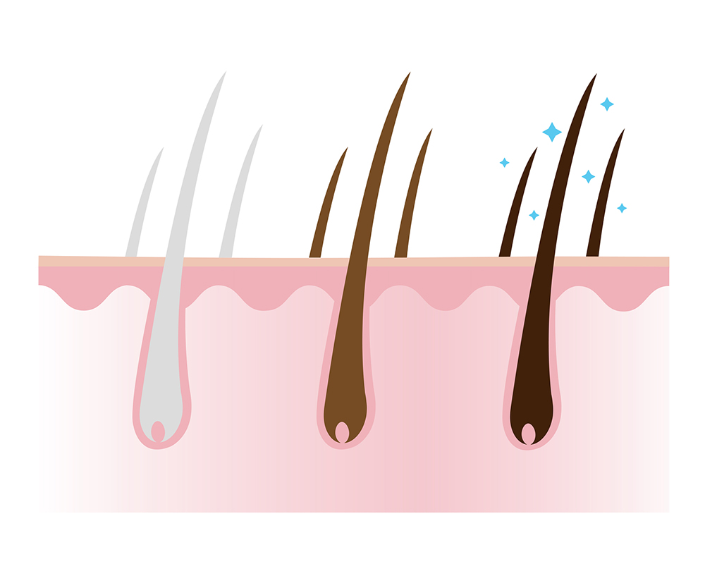ถอนผมหงอก ทำให้ผมหงอกยิ่งขึ้น