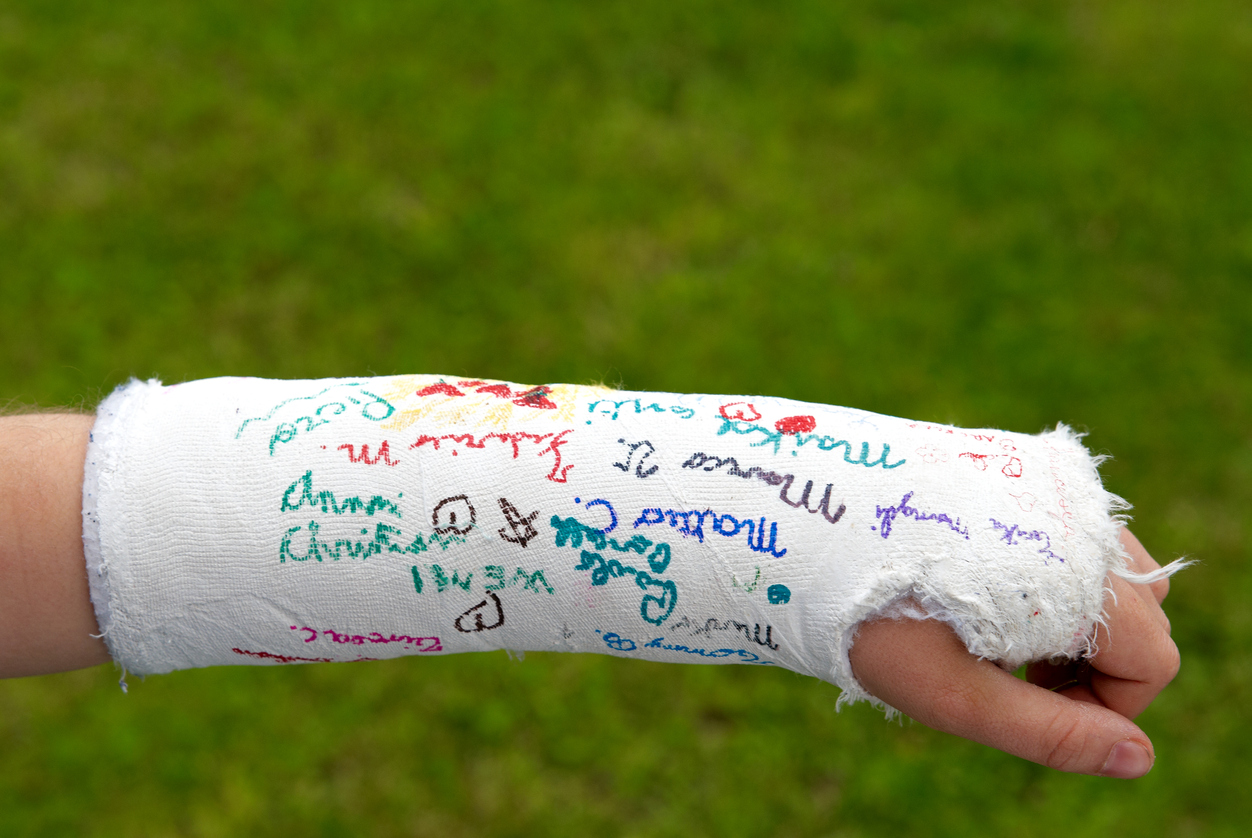 เขียนบนเฝือก