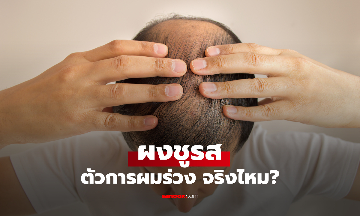 กินผงชูรสบ่อยๆ ผมจะร่วงไหม? ทำมาจากอะไร ผู้เชี่ยวชาญมีคำตอบ