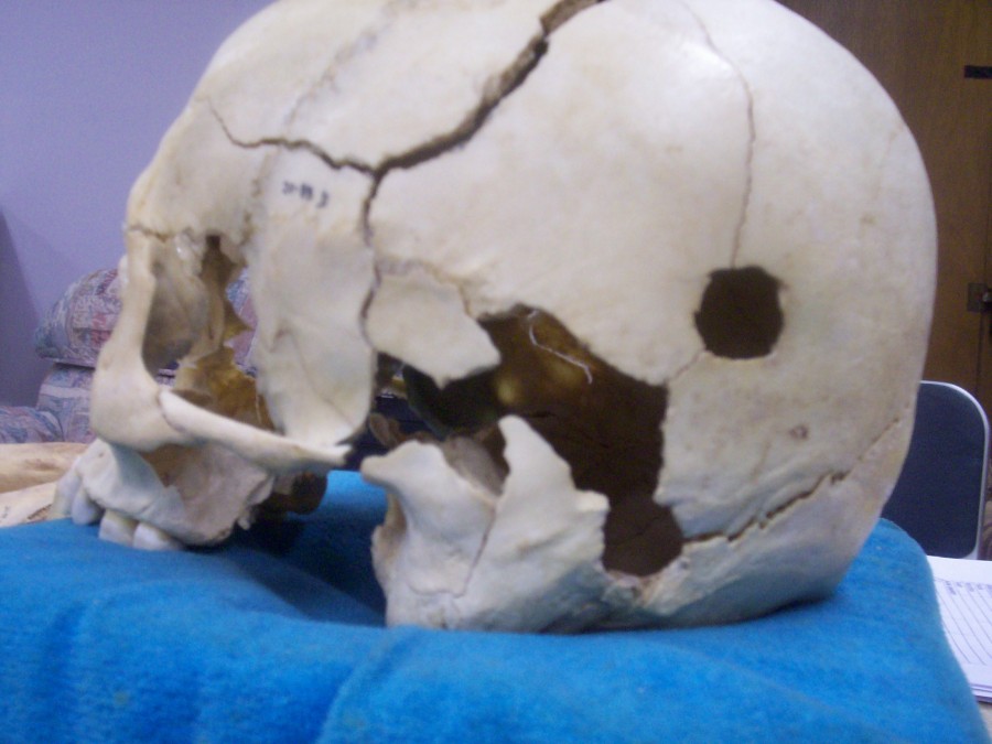 ฟาร์มศพ