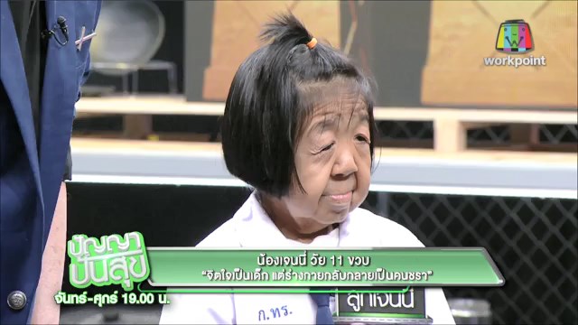 โรคชราในวัยเด็ก