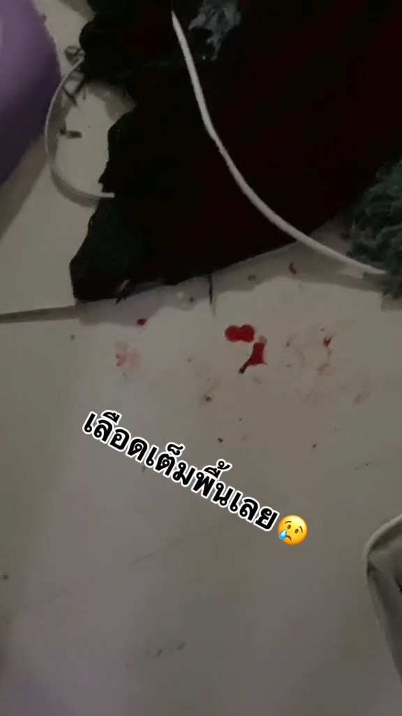 ยายล้มหัวแตก