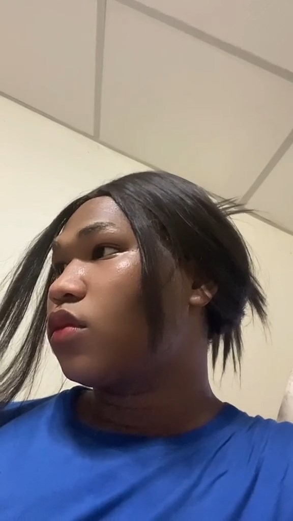 ยายล้มหัวแตก