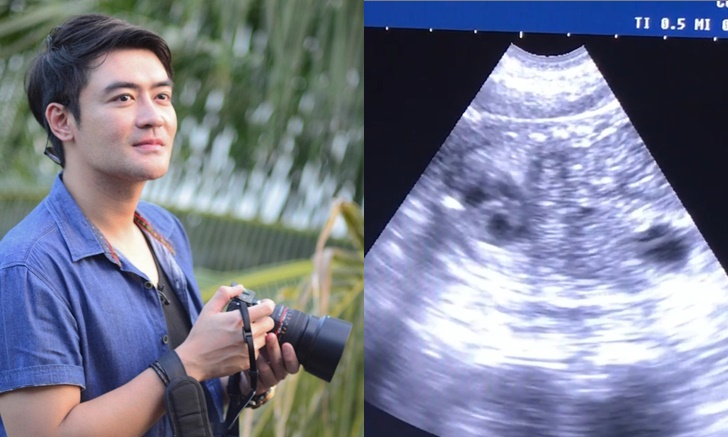 คนแห่ยินดี