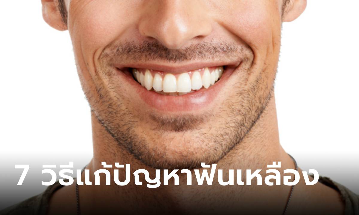 7 วิธีแก้ปัญหาฟันเหลือง ให้คุณยิ้มกว้างได้อย่างมั่นใจอีกครั้ง!