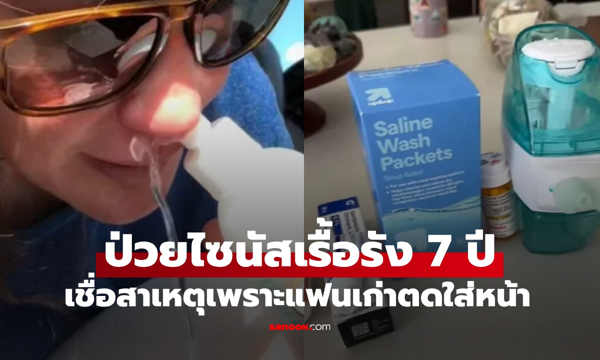 สาวป่วยไซนัสเรื้อรัง 7 ปี เชื่อสาเหตุเพราะแฟนเก่า "ตดใส่หน้า" หมอฟังแล้วส่ายหน้า