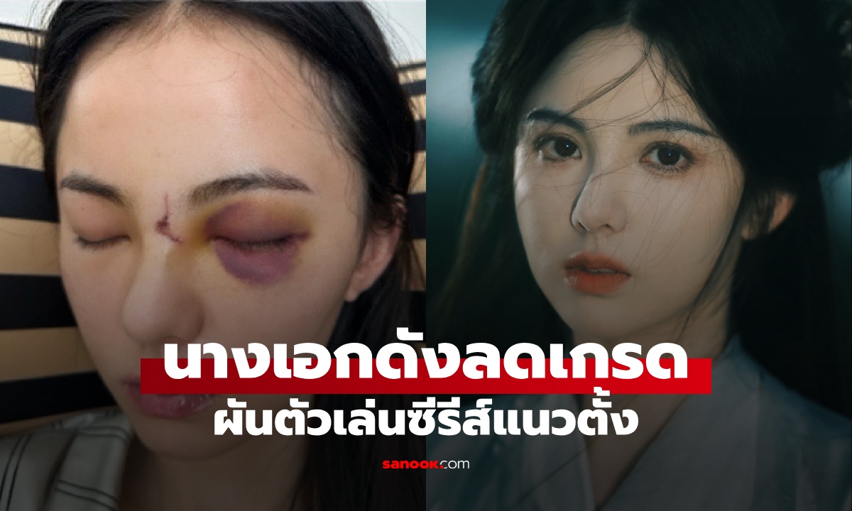 สะเทือนวงการ! นางเอกดัง "ลดเกรด" เล่นซีรีส์แนวตั้ง จุดเปลี่ยนหลังอุบัติเหตุหวิดเสียโฉม