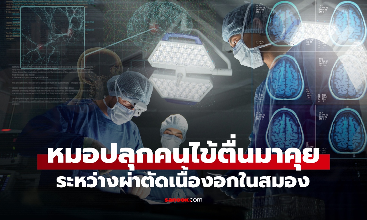 แค่คิดก็อึ้ง หมอปลุกคนไข้ให้ตื่นมาคุย ระหว่างผ่าตัด "เปิดกะโหลก" รักษาเนื้องอกในสมอง