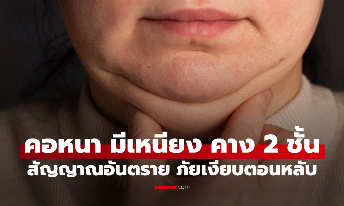 มีเหนียง คาง 2 ชั้น ไม่ใช่เรื่องเล่นๆ หมอเตือนเป็นสัญญาณอันตราย ภัยเงียบตอนหลับ