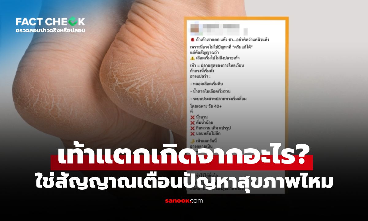 "เท้าแตก" สัญญาณเตือนปัญหาสุขภาพ โดยเฉพาะวัย 40+ จริงหรือไม่? : เช็กข่าวชัวร์