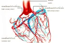 โรคหลอดเลือดในสมองและหลอดเลือดหัวใจ