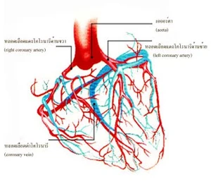 โรคหลอดเลือดในสมองและหลอดเลือดหัวใจ