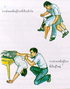 การผายปอด