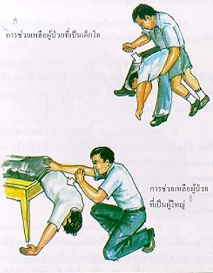 การผายปอด