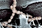 โรคติดเชื้อสเตรปโตคอกคัส ซูอิส (Streptococcus suis )