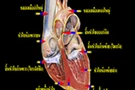 กายภาพของหลอดเลือดหัวใจตีบและการรักษา