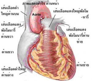 การรักษาโรคหัวใจเต้นผิดจังหวะด้วยการผ่าตัด