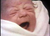 หลุยส์ บราวน์ (Louise Joy Brown) เมื่แรกเกิด