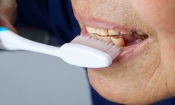 วิธีดูแลฟันของผู้สูงอายุนอนติดเตียง ป้องกันแผลติดเชื้อในปาก
