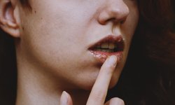 6 วิธีง่ายๆ ช่วยรักษาริมฝีปากดำคล้ำ