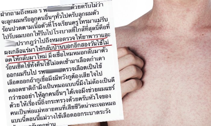 แพทย์แจง! ไข้เลือดออก วันแรกให้ทานพารา เกลือแร่ ไม่ผิด!