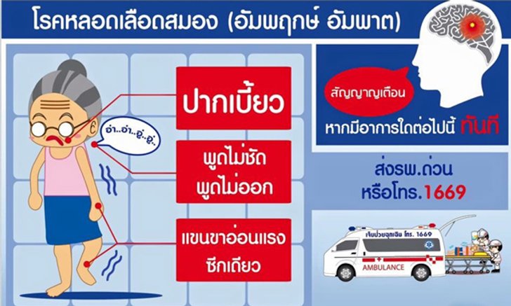 วิธีปฐมพยาบาลผู้ป่วย "หลอดเลือดสมองแตก"
