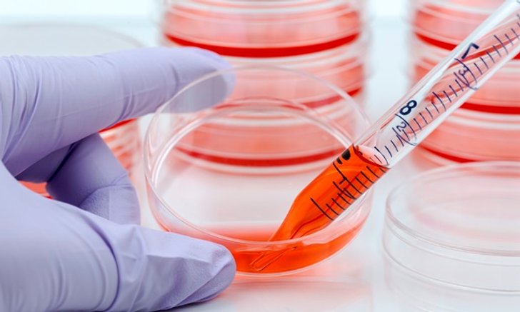 สเต็มเซลล์ (Stem Cell) เซลล์ต้นกำเนิด คืออะไร บริจาคอย่างไร