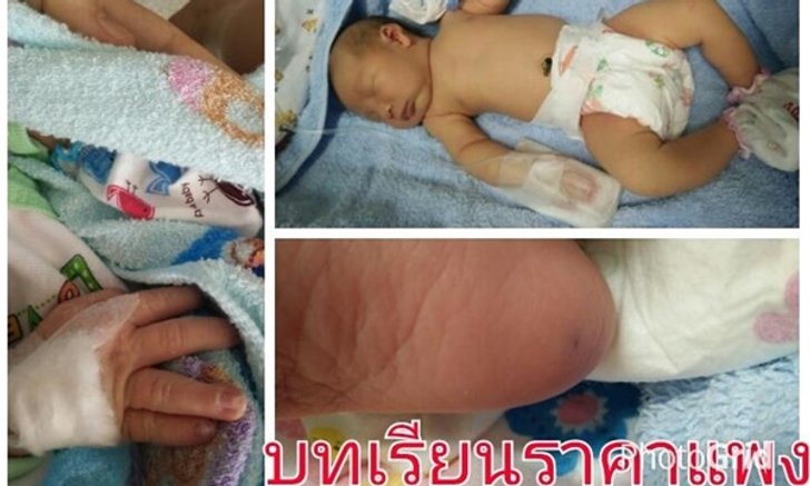 อุทาหรณ์! เด็กติดเชื้อในกระแสเลือด เพราะญาติแห่อุ้ม-กอดมากเกินไป