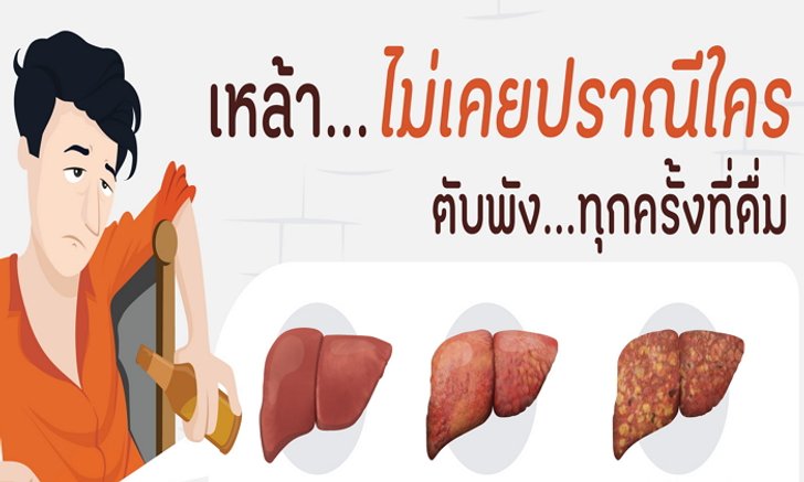 อันตราย! ทุกครั้งที่ดื่มเหล้า “ตับตาย” ไม่รู้ตัว