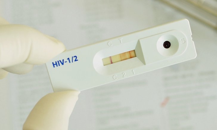 “ชุดตรวจ HIV ด้วยตัวเอง” ประโยชน์-ข้อควรระวังที่ควรรู้ก่อนซื้อใช้