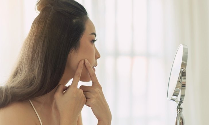 “ฝี” เกิดจากอะไร ? ทำไมถึงห้าม “บีบ” เอง?