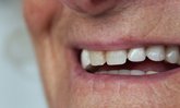 6 ปัญหาสุขภาพช่องปาก ที่มักเกิดขึ้นกับผู้สูงอายุ