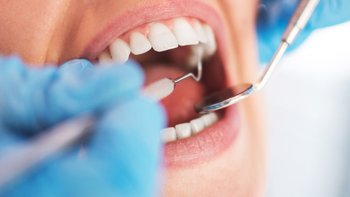 "ฟันคุด" คืออะไร อันตรายไหม ต้องผ่าตอนไหน