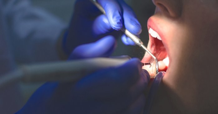 ทันตแพทย์ยัน “วัคซีนโควิด-19” ไม่มีผลต่อการทำฟัน