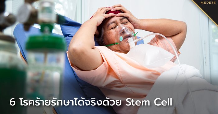 6 โรคร้ายกับแนวทางการรักษาด้วย Stem cell