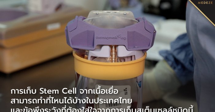 การเก็บ Stem Cell จากเนื้อเยื่อสามารถทำที่ไหนได้บ้างในประเทศไทย และข้อพึงระวังที่ต้องใส่ใจจากการเก็บสเต็มเซลล์ชนิดนี้