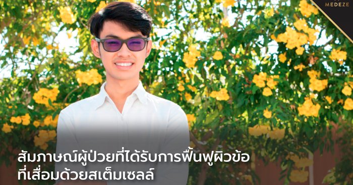 สัมภาษณ์ผู้ป่วยที่ได้รับการฟื้นฟูผิวข้อที่เสื่อมด้วย สเต็มเซลล์